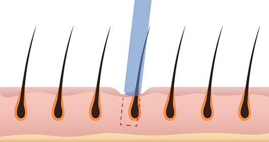 무딘 날 사용 일러스트 이미지