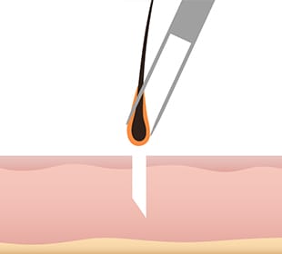 슬릿이 작은 경우 일러스트 이미지