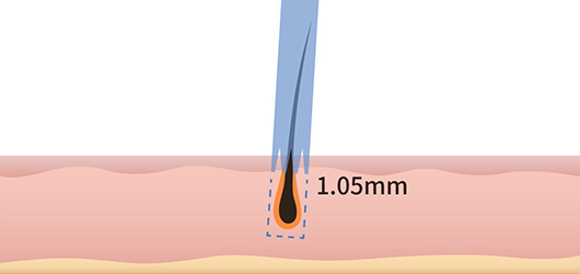 For Hair punch diameter of 1~1.05mm image