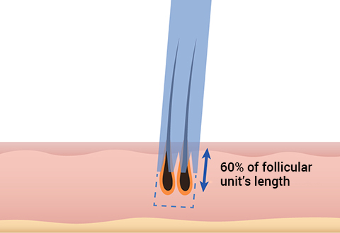 60~70% of their length image