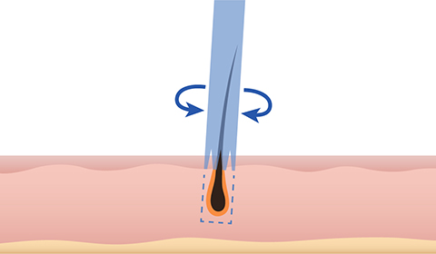 Dual directional rotation image