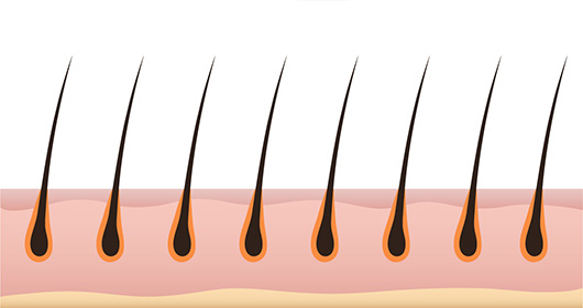 For Hair’s high density slit implantation image