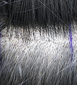 Only hair follicles to be collected are cut short image