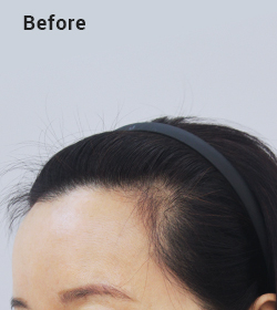 Natural hairline texture image