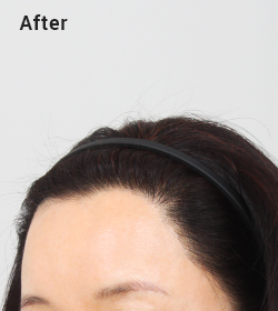 Natural hairline texture image